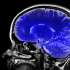 Заболевания мозга могут возникать от бытовой химии — ученые