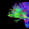 Фото Открытие интерактивной выставки Мозг: Вселенная внутри нас