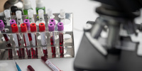 В Ленобласти можно бесплатно сдать тест на антитела к коронавирусу