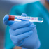 Вирусолог рассказал, действительно ли вакцинация от ковида породила новую болезнь