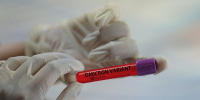 Вирусолог оценил опасность подвида омикрон-штамма «кентавр»