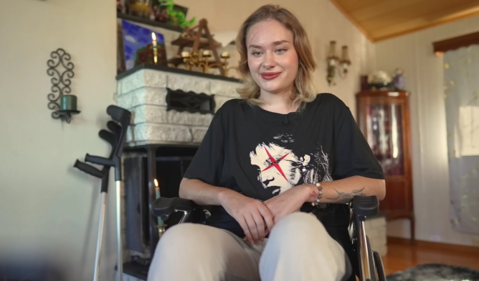 Мария Ковальчук не скрывает шрам и уверенно смотрит в будущее