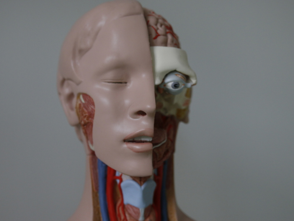 Метаболический синдром увеличивает риск развития болезни Паркинсона на 40%