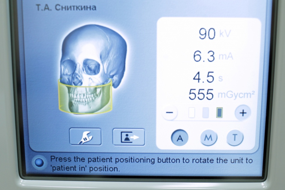 Состояние зубов может указывать на риск преждевременной смерти