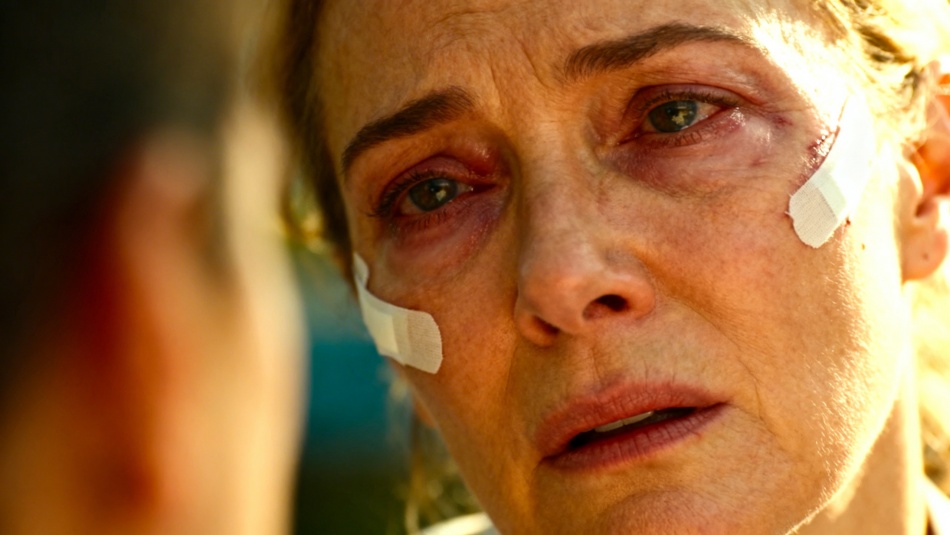 Пластика век и лба: как выбрать подходящий вариант и не разочароваться