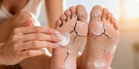 Педикюр без риска: как ухаживать за пятками дома весной