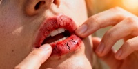 Врач объяснила, почему появляются трещины в уголках губ